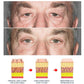 OPENEYES Awaken Lifting Eye Gel （1+1 Buy One Get One Free）