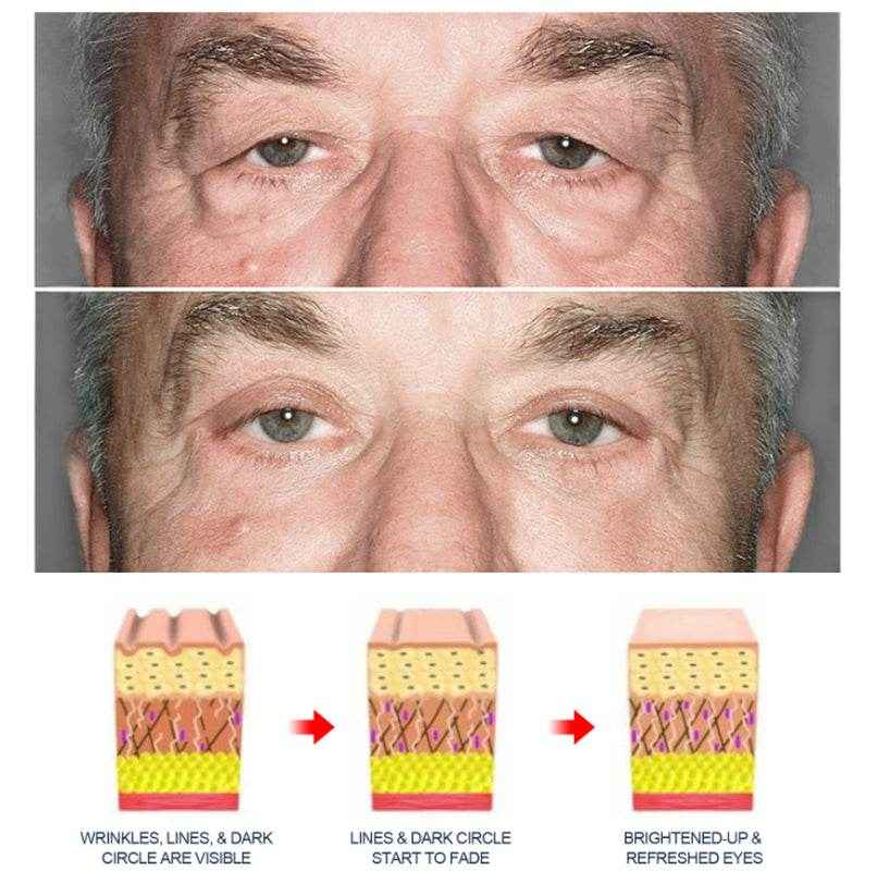 OPENEYES Awaken Lifting Eye Gel （1+1 Buy One Get One Free）