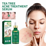 Tea Tree Oil Acne essence Attenuates Acne Print Facial
