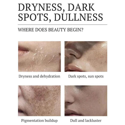 Brightening Dark Spot Corrector Cream 20g Salicylic
