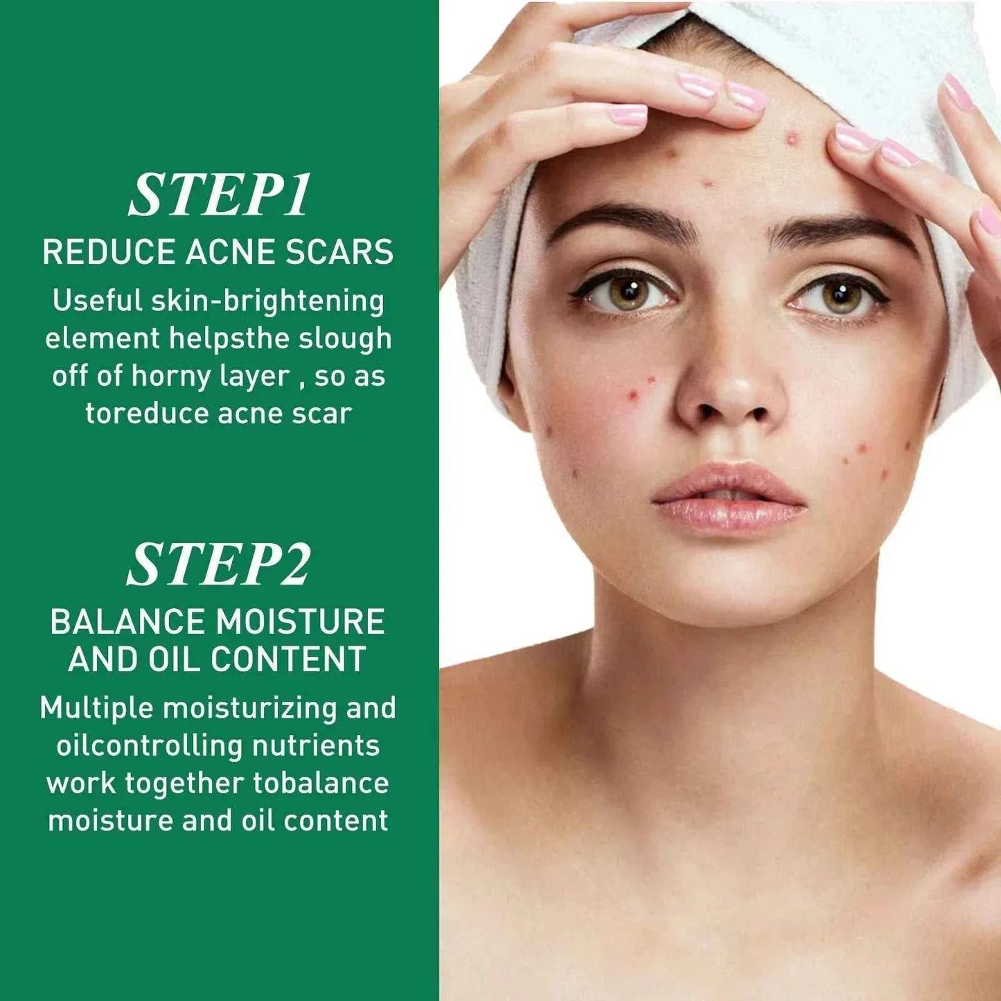 Tea Tree Oil Acne essence Attenuates Acne Print Facial