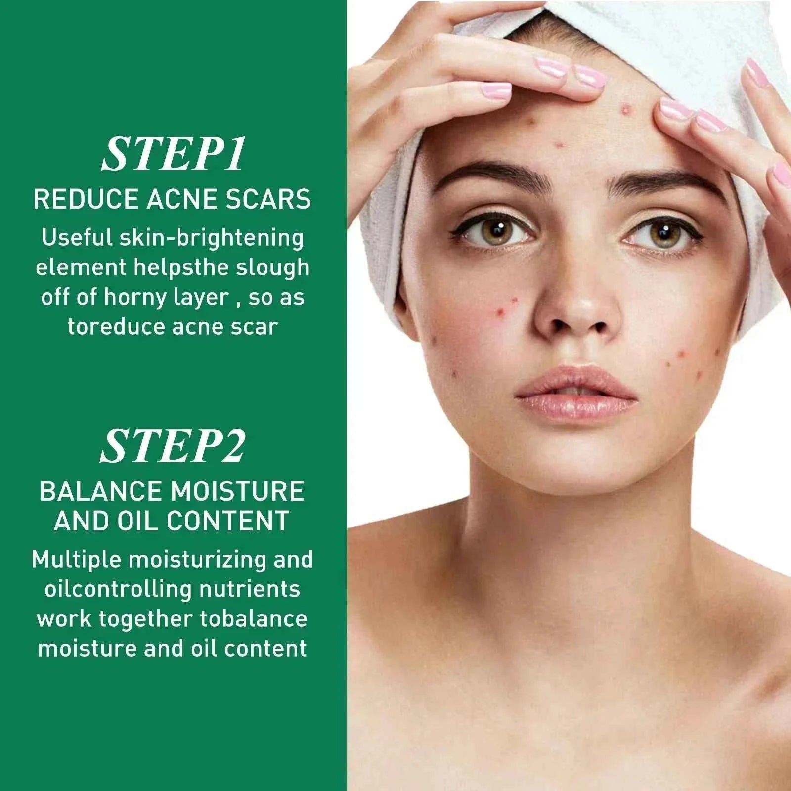 Tea Tree Oil Acne essence Attenuates Acne Print Facial