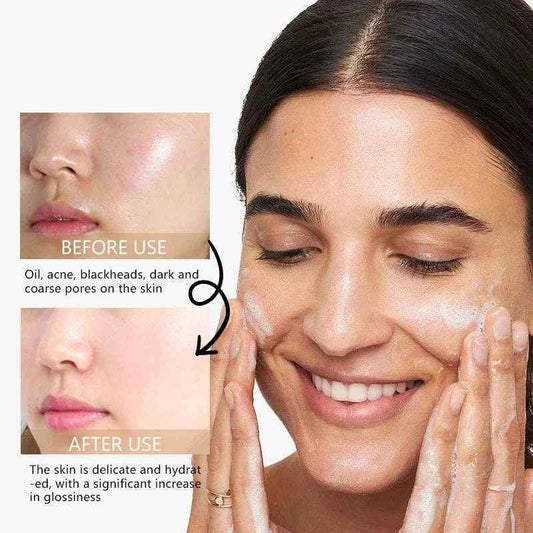 RAVE LADY Low PH 150ml Facial Cleanser Gentle Oil Control Moisturizing